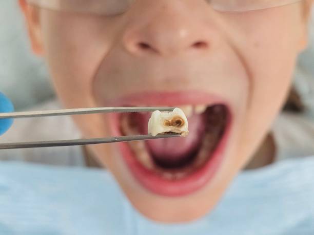 Best Weekend Emergency Dentist in Lacon, IL