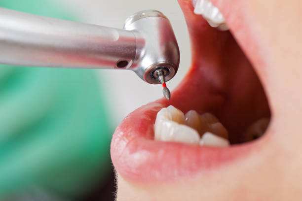 Best Walk-In Emergency Dentist in Lacon, IL